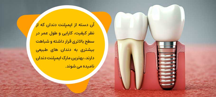 بهترین برند ایمپلنت دندان در ایران